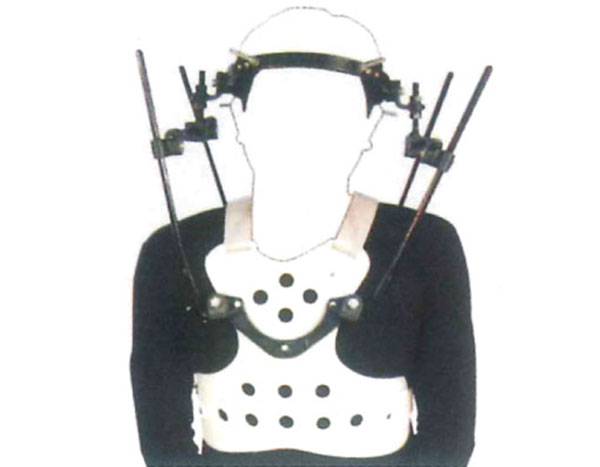 為何都選它？矯形器出售中碳纖維材質(zhì)優(yōu)勢(shì)盤(pán)點(diǎn)